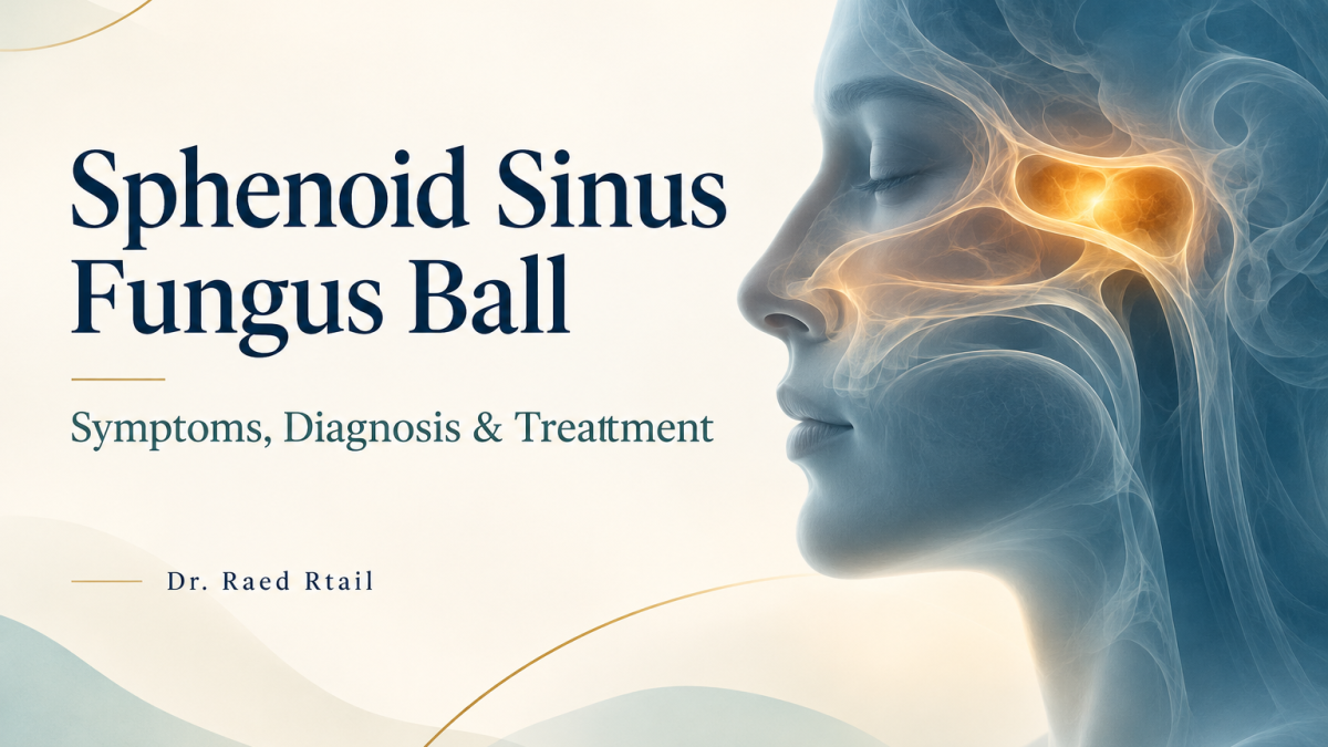Illustrated cover for Sphenoid Sinus Fungus Ball: Symptoms, Diagnosis and Treatment by Dr. Raed Rtail